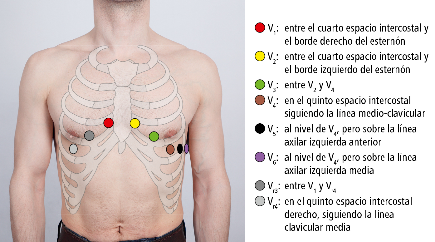 Electrocardiografía 3926