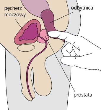 prostata wikipedia polska
