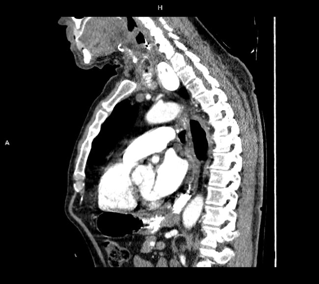 Jaka patologia widoczna jest na radiogramie i tomografii? cz. 173