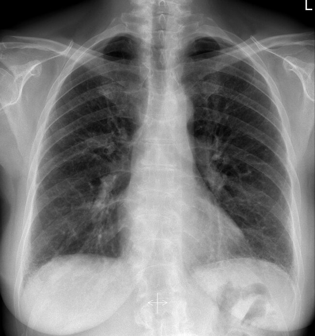 Jaka patologia widoczna jest na radiogramie i tomografii? cz. 156