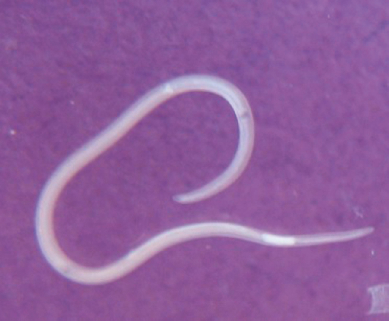 Личинки селёдочного червя (Anisakis Simplex)
