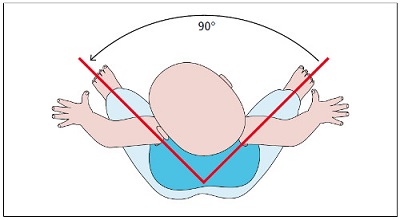 Правильне відведення кульшових суглобів — у кожному суглобі до приблизно 45° (рис. Maciej Sarna) 
