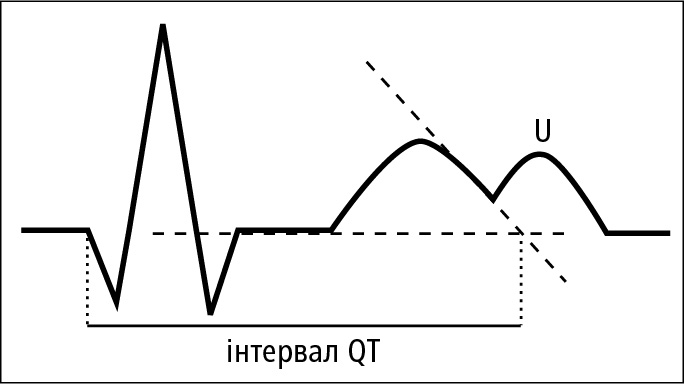 Визначення тривалості інтервалу QT