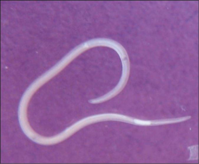 Figure 031_0801.   Anisakis simplex  larva with visible ventriculus. 