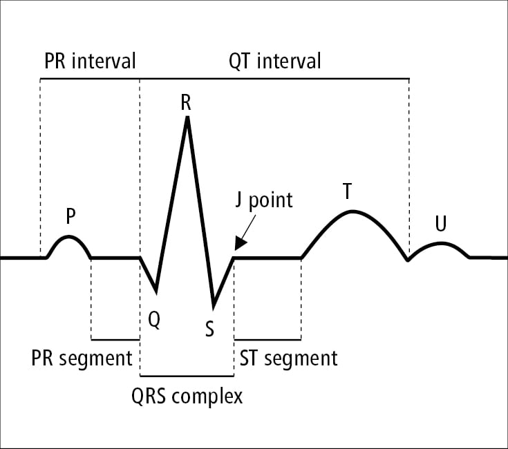 Figure 031_3492.  Waves, segments, and intervals in electrocardiography (ECG). 