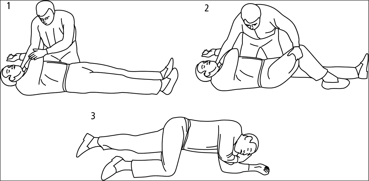 Figure 031_4_7712.  Placing an unconscious patient in the recovery position. 