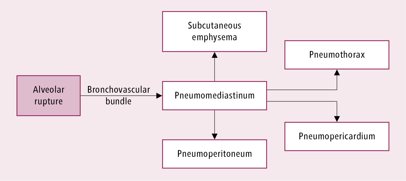 Figure 031_9881.  Pathophysiology of pneumomediastinum and associated complications. 