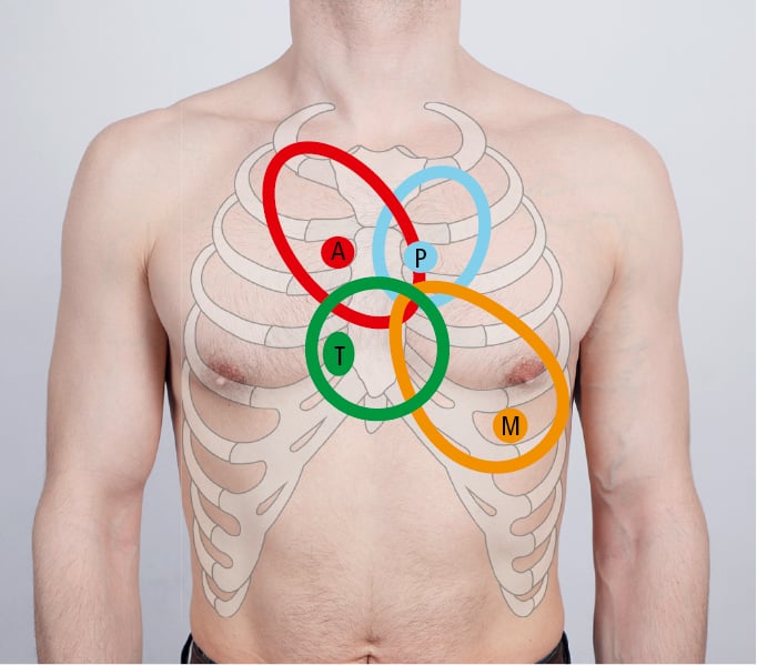 Figure 031_9939.  Areas of auscultation of the heart. 