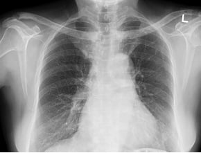 Радиологическая диагностика: 40-летняя женщина с хронической болью в груди