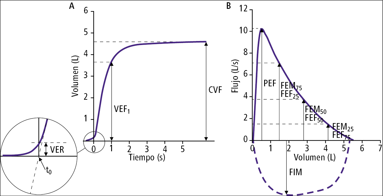    Fig. 27.4-2.  Curva volumen-tiempo  (A)  y flujo-volumen  (B)  