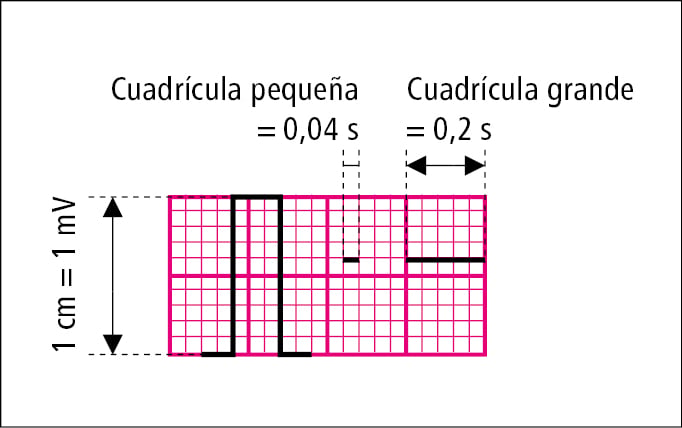    Fig. 27.1-3.  Utilización del papel milimetrado para la medición de la duración (con una velocidad estándar de desplazamiento de 25 mm/s) y de la amplitud de los elementos morfológicos particulares del electrocardiograma 