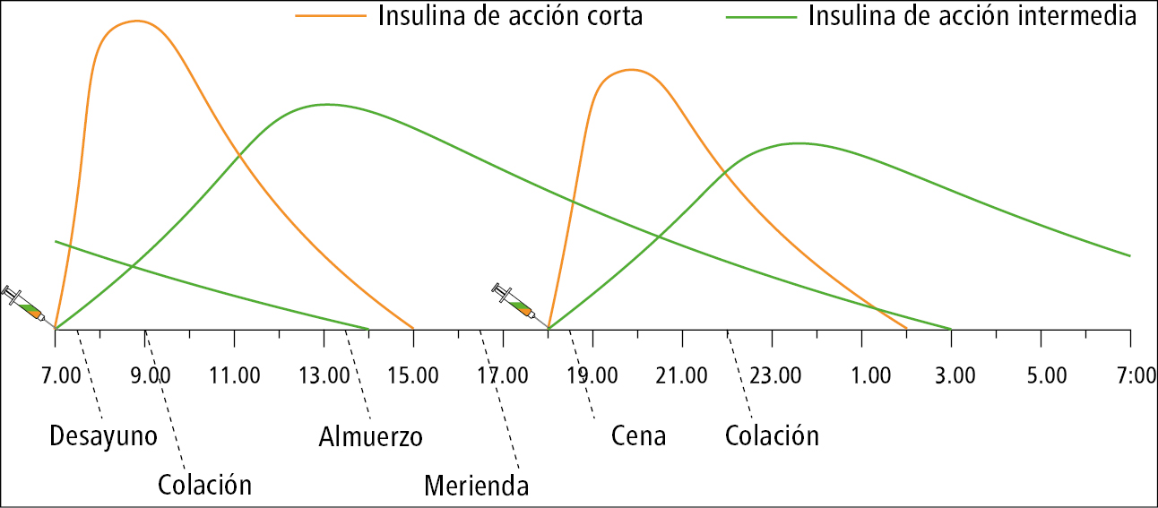    Fig. 14.1-6.  Esquema de tratamiento con mezclas de insulinas humanas administradas 2 × día (insulina de acción corta con insulina de acción intermedia) 