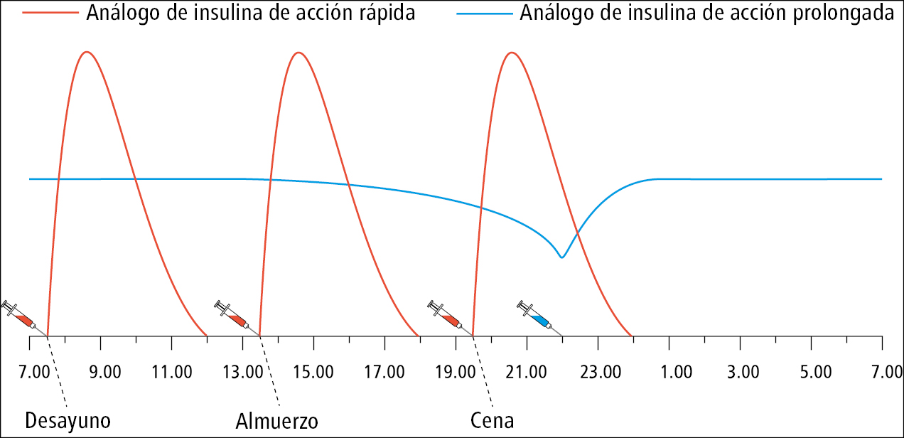    Fig. 14.1-5.  Insulinoterapia intensiva en pauta de 4 inyecciones al día: análogo de insulina de acción rápida en combinación con análogo de acción prolongada 