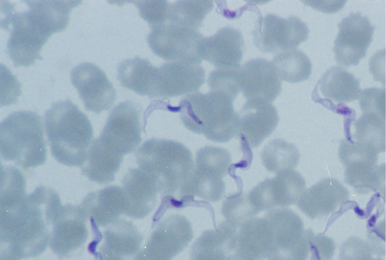    Fig. 19.4-1.  Formas de tripomastigote de  T. brucei rhodesiense  en sangre periférica en un paciente al regreso de Uganda. Frotis fino de sangre periférica teñido con Giemsa 