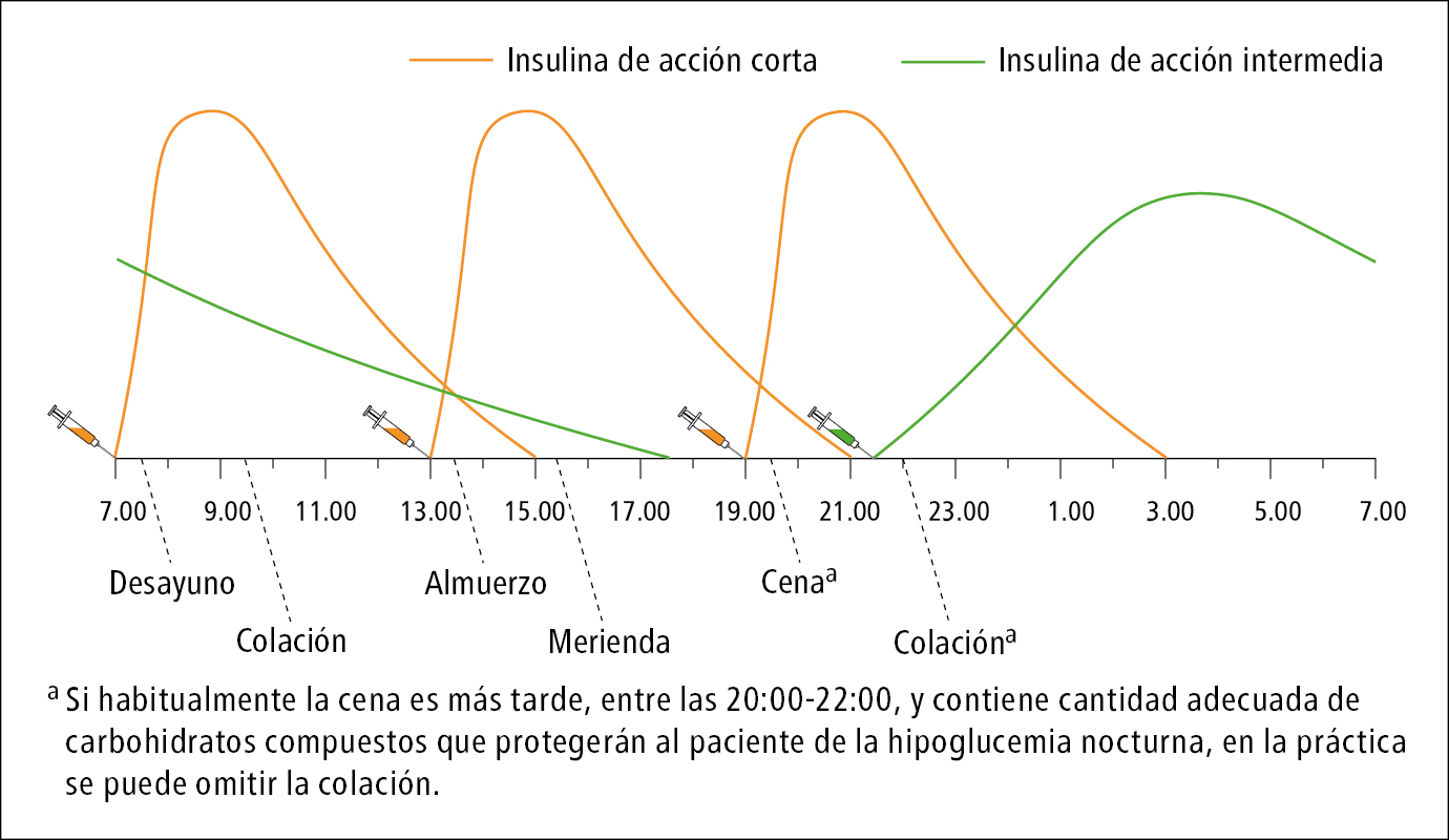    Fig. 14.1-4.  Insulinoterapia intensiva en pauta de 4 inyecciones al día: insulina de acción corta en combinación con insulina de acción intermedia (NPH) 
