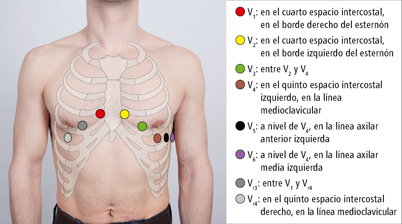    Fig. 27.1-1.  Colocación de los electrodos del ECG 