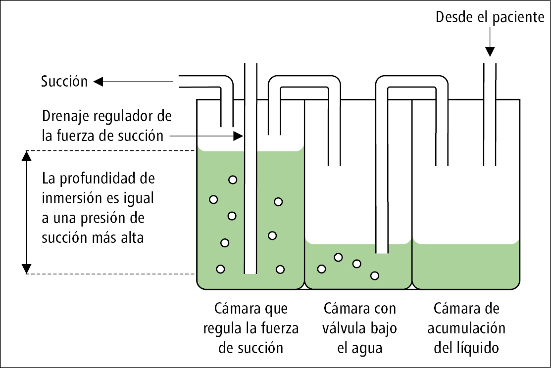    Fig. 26.9-1.  Sistema de tres cámaras para el drenaje pleural 