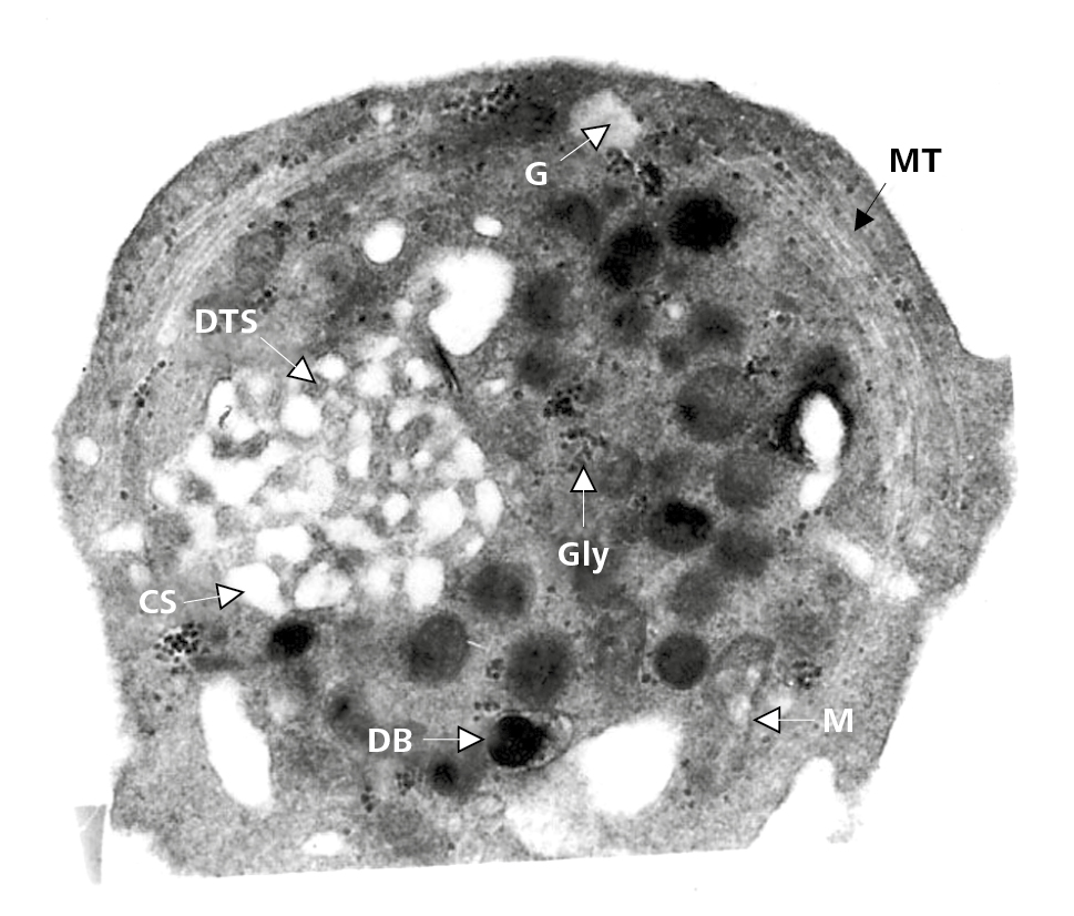  Płytka krwi (mikroskopia elektronowa). CS – układ kanalików otwartych, DB – ziarnistości gęste δ, DTS – układ kanalików gęstych, G – ziarnistości α, Gly – glikogen, M – mitochondrium, MT – mikrotubule 